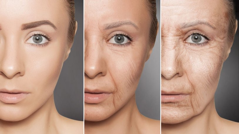 anti aging krem ​​nedir