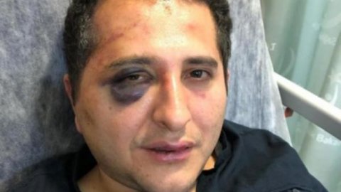 Erdoğan'ın korumalarının saldırısına uğrayan Avukat Sürenoğlu: Kuralsızlık kural olmuş