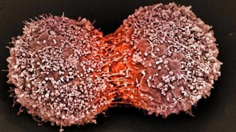 Röntgen ile kanser riski arasında bağ tespit edildi 