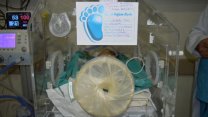 'Makatsız' dünyaya gelen bebeğe 2,5 saatlik operasyonla makat yapıldı
