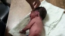 Doktorlar ayak yerine boynuzla doğan bebeği görünce şaşkına döndü